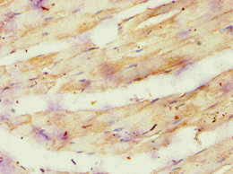 ATP5O Antibody - Immunohistochemistry of paraffin-embedded human skeletal muscle tissue using ATP5O Antibody at dilution of 1:100