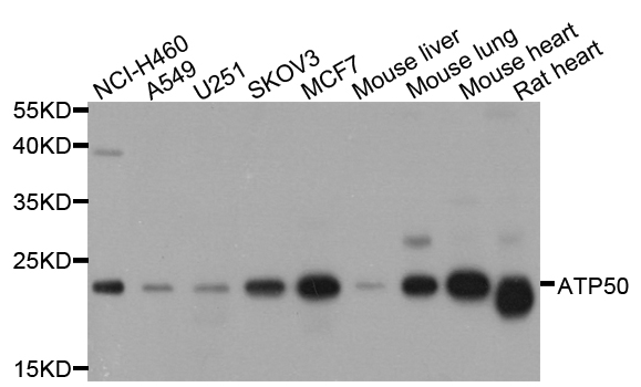 ATP5O Antibody - Western blot analysis of extract of various cells.