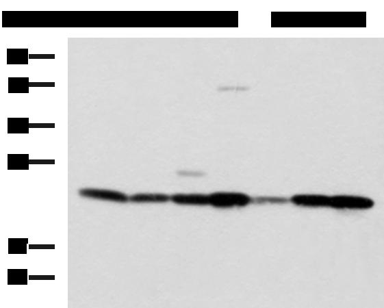 ATP5O Antibody - Western blot analysis of SKOV3 Hela cell Mouse liver tissue Mouse heart tissue Human placenta tissue HepG2 cell Human heart tissue lysates  using ATP5O Polyclonal Antibody at dilution of 1:1250