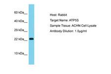 ATP5S Antibody -  This image was taken for the unconjugated form of this product. Other forms have not been tested.