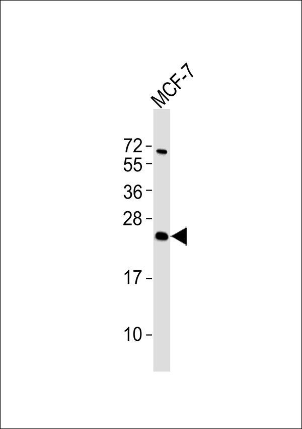ATP5S Antibody - Anti-ATP5S Antibody at 1:1000 dilution + MCF-7 whole cell lysates Lysates/proteins at 20 ug per lane. Secondary Goat Anti-Rabbit IgG, (H+L),Peroxidase conjugated at 1/10000 dilution Predicted band size : 25 kDa Blocking/Dilution buffer: 5% NFDM/TBST.