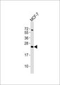 ATP5S Antibody - Anti-ATP5S Antibody at 1:1000 dilution + MCF-7 whole cell lysates Lysates/proteins at 20 ug per lane. Secondary Goat Anti-Rabbit IgG, (H+L),Peroxidase conjugated at 1/10000 dilution Predicted band size : 25 kDa Blocking/Dilution buffer: 5% NFDM/TBST.