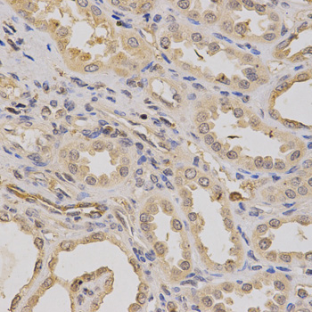 ATP6AP1 Antibody - Immunohistochemistry of paraffin-embedded human kidney tissue.