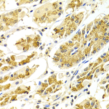 ATP6AP1 Antibody - Immunohistochemistry of paraffin-embedded Human gastric tissue.
