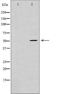 ATP6AP1 Antibody - Western blot analysis of mouse kidney lysate using ATP6AP1 antibody. The lane on the left is treated with the antigen-specific peptide.