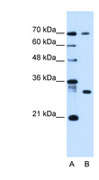 ATP6AP1L Antibody - ATP6AP1L antibody ARP44720_P050-NP_001017971-LOC92270(hypothetical protein LOC92270) Antibody Western blot of HepG2 cell lysate.  This image was taken for the unconjugated form of this product. Other forms have not been tested.
