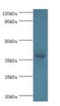 ATP6AP2 / Renin Receptor Antibody - Western blot. All lanes: Renin receptor antibody at 2 ug/ml+HeLa whole cell lysate. Secondary antibody: goat polyclonal to rabbit at 1:10000 dilution. Predicted band size: 39 kDa. Observed band size: 39 kDa.  This image was taken for the unconjugated form of this product. Other forms have not been tested.