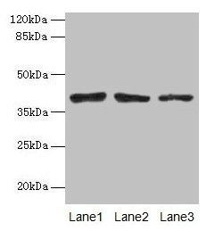 ATP6AP2 / Renin Receptor Antibody - Western blot All lanes: Renin receptor antibody at 10µg/ml Lane 1: Mouse ocular tissue Lane 2: COLO205 whole cell lysate Lane 3: Hela whole cell lysate Secondary Goat polyclonal to rabbit IgG at 1/10000 dilution Predicted band size: 40, 36 kDa Observed band size: 40 kDa