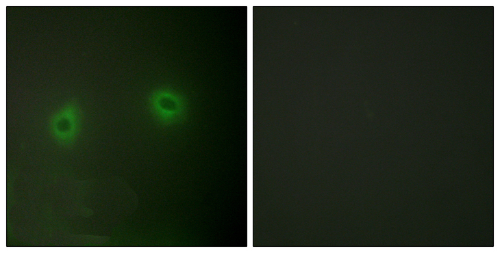 ATP6AP2 / Renin Receptor Antibody - Immunofluorescence analysis of HeLa cells, using Caper Antibody. The picture on the right is blocked with the synthesized peptide.