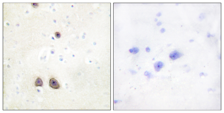 ATP6AP2 / Renin Receptor Antibody - Immunohistochemistry analysis of paraffin-embedded human brain tissue, using Caper Antibody. The picture on the right is blocked with the synthesized peptide.