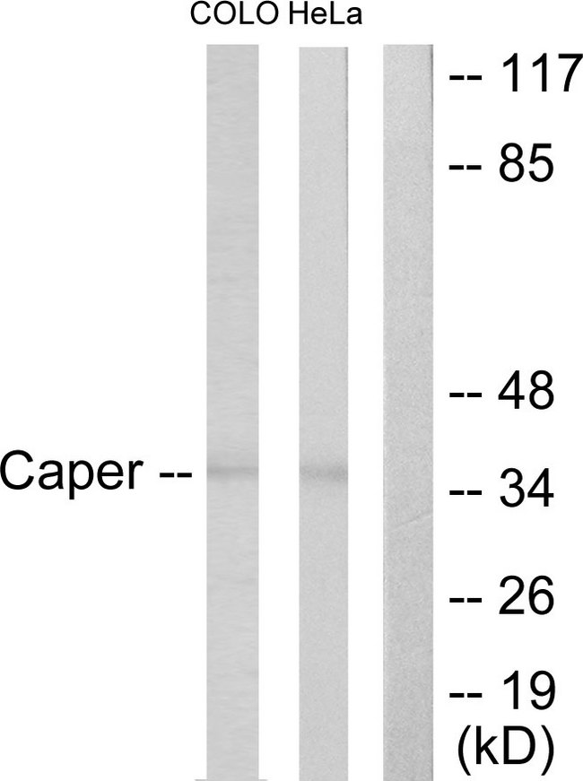 ATP6AP2 / Renin Receptor Antibody - Western blot analysis of lysates from COLO205 and HeLa cells, using Caper Antibody. The lane on the right is blocked with the synthesized peptide.