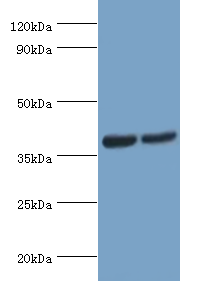 ATP6AP2 / Renin Receptor Antibody - Western blot. All lanes: Renin receptor antibody at 2 ug/ml. Lane 1: HeLa whole cell lysate. Lane 2: mouse heart tissue. Secondary antibody: Goat polyclonal to rabbit at 1:10000 dilution. Predicted band size: 39 kDa. Observed band size: 39 kDa.