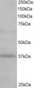 ATP6AP2 / Renin Receptor Antibody - ATP6AP2 / Renin Receptor antibody staining (0.5µg/ml) of Human Kidney lysate (RIPA buffer, 35µg total protein per lane). Primary incubated for 1 hour. Detected by chemiluminescence.