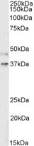 ATP6AP2 / Renin Receptor Antibody - ATP6AP2 / Renin Receptor antibody (2µg/ml) of Mouse Kidney lysate (RIPA buffer, 35µg total protein per lane). Detected by chemiluminescence.