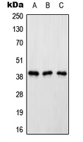 ATP6AP2 / Renin Receptor Antibody - Western blot analysis of Renin Receptor expression in HeLa (A); Raw264.7 (B); rat kidney (C) whole cell lysates.