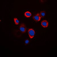 ATP6AP2 / Renin Receptor Antibody - Immunofluorescent analysis of Renin Receptor staining in Raw264.7 cells. Formalin-fixed cells were permeabilized with 0.1% Triton X-100 in TBS for 5-10 minutes and blocked with 3% BSA-PBS for 30 minutes at room temperature. Cells were probed with the primary antibody in 3% BSA-PBS and incubated overnight at 4 C in a humidified chamber. Cells were washed with PBST and incubated with a DyLight 594-conjugated secondary antibody (red) in PBS at room temperature in the dark. DAPI was used to stain the cell nuclei (blue).