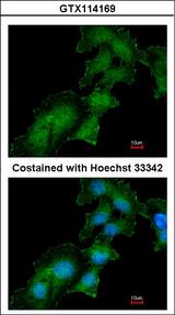 ATP6AP2 / Renin Receptor Antibody - Immunofluorescence of methanol-fixed HepG2, using Renin Receptor antibody at 1:200 dilution.
