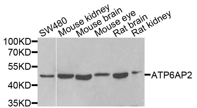 ATP6AP2 / Renin Receptor Antibody - Western blot analysis of extracts of various cells.