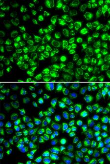 ATP6AP2 / Renin Receptor Antibody - Immunofluorescence analysis of HeLa cells.
