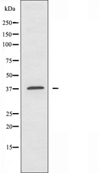 ATP6AP2 / Renin Receptor Antibody - Western blot analysis of extracts of COLO205 cells using Caper antibody.