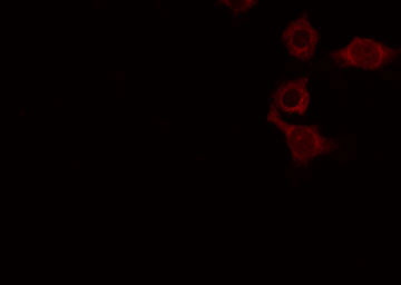 ATP6AP2 / Renin Receptor Antibody - Staining COLO205 cells by IF/ICC. The samples were fixed with PFA and permeabilized in 0.1% Triton X-100, then blocked in 10% serum for 45 min at 25°C. The primary antibody was diluted at 1:200 and incubated with the sample for 1 hour at 37°C. An Alexa Fluor 594 conjugated goat anti-rabbit IgG (H+L) Ab, diluted at 1/600, was used as the secondary antibody.