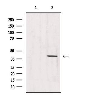 ATP6AP2 / Renin Receptor Antibody - Western blot analysis of extracts of 293 cells using Caper antibody. Lane 1 was treated with the blocking peptide.