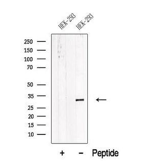ATP6E / ATP6V1E1 Antibody - Western blot analysis of extracts of 3T3 cells using ATP6V1E1 antibody. The lane on the left was treated with blocking peptide.