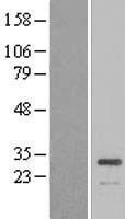 ATP6E / ATP6V1E1 Protein - Western validation with an anti-DDK antibody * L: Control HEK293 lysate R: Over-expression lysate