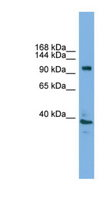 ATP6V0A1 Antibody - ATP6V0A1 antibody Western blot of Mouse Uterus lysate. This image was taken for the unconjugated form of this product. Other forms have not been tested.
