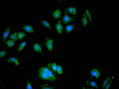 ATP6V0A1 Antibody - Immunofluorescent analysis of A549 cells at a dilution of 1:100 and Alexa Fluor 488-congugated AffiniPure Goat Anti-Rabbit IgG(H+L)