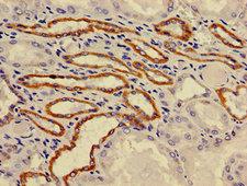ATP6V0A1 Antibody - Immunohistochemistry image of paraffin-embedded human kidney tissue at a dilution of 1:100
