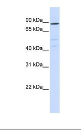 ATP6V0A2 Antibody - Hela cell lysate. Antibody concentration: 1.0 ug/ml. Gel concentration: 12%.  This image was taken for the unconjugated form of this product. Other forms have not been tested.