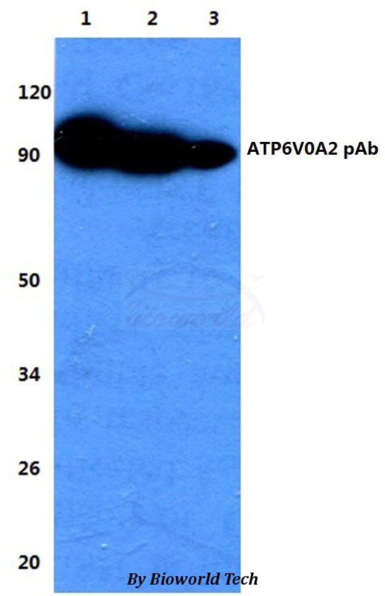 ATP6V0A2 Antibody - Western blot of ATP6V0A2 antibody at 1:500 dilution. Lane 1: HEK293T whole cell lysate. Lane 2: sp2/0 whole cell lysate. Lane 3: H9C9 whole cell lysate.