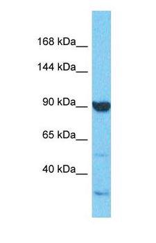 ATP6V0A2 Antibody - Western blot of ATP6V0A2 Antibody with human A549 Whole Cell lysate.  This image was taken for the unconjugated form of this product. Other forms have not been tested.