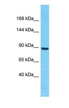 ATP6V0A4 Antibody - Western blot of ATP6V0A4 Antibody with human HepG2 Whole Cell lysate.  This image was taken for the unconjugated form of this product. Other forms have not been tested.
