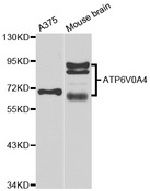 ATP6V0A4 Antibody - Western blot analysis of extracts of various cell lines.