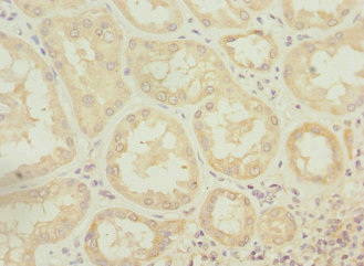 ATP6V0A4 Antibody - Immunohistochemistry of paraffin-embedded human kidney tissue at dilution 1:100