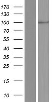ATP6V0A4 Protein - Western validation with an anti-DDK antibody * L: Control HEK293 lysate R: Over-expression lysate