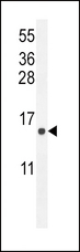 ATP6V0B Antibody - ATP6V0B Antibody western blot of U251 cell line lysates (35 ug/lane). The EKI2 antibody detected the EKI2 protein (arrow).