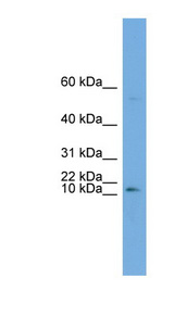 ATP6V0C / VATL Antibody - ATP6V0C antibody Western blot of OVCAR-3 cell lysate. This image was taken for the unconjugated form of this product. Other forms have not been tested.