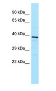ATP6V0D1 Antibody - ATP6V0D1 antibody Western Blot of HeLa.  This image was taken for the unconjugated form of this product. Other forms have not been tested.