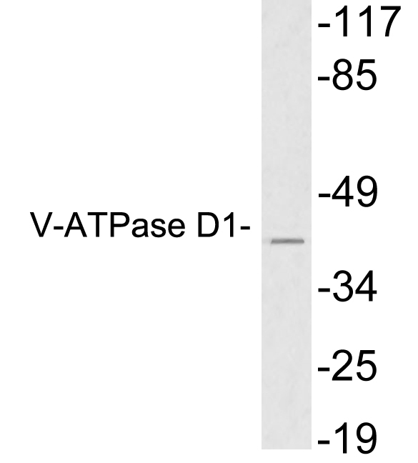 ATP6V0D1 Antibody - Western blot analysis of lysates from HeLa cells, using V-ATPase D1 antibody.