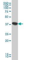 ATP6V0D1 Antibody - ATP6V0D1 monoclonal antibody (M01), clone 2G12 Western blot of ATP6V0D1 expression in HeLa.