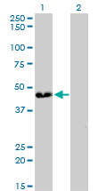 ATP6V0D1 Antibody - Western blot of ATP6V0D1 expression in transfected 293T cell line by ATP6V0D1 monoclonal antibody (M01), clone 2G12.
