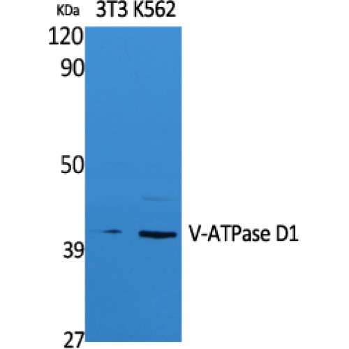 ATP6V0D1 Antibody - Western blot of V-ATPase D1 antibody