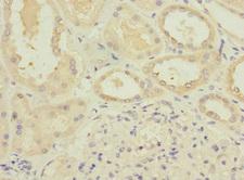 ATP6V0D1 Antibody - Immunohistochemistry of paraffin-embedded human kidney tissue at dilution 1:100