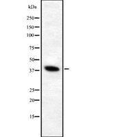 ATP6V0D1 Antibody - Western blot analysis of V-ATPase D1 using HeLa whole cells lysates