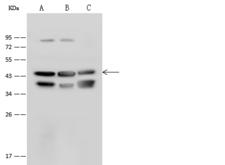 ATP6V0D1 Antibody - Anti-ATP6V0D1 rabbit polyclonal antibody at 1:500 dilution. Lane A: HeLa Whole Cell Lysate. Lane B: MCF-7 Whole Cell Lysate. Lane C: A431 Whole Cell Lysate. Lysates/proteins at 30 ug per lane. Secondary: Goat Anti-Rabbit IgG (H+L)/HRP at 1/10000 dilution. Developed using the ECL technique. Performed under reducing conditions. Predicted band size: 40 kDa. Observed band size: 44 kDa. (We are unsure as to the identity of these extra bands.)