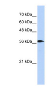 ATP6V0D2 Antibody - ATP6V0D2 antibody Western blot of Transfected 293T cell lysate. This image was taken for the unconjugated form of this product. Other forms have not been tested.