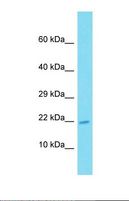 ATP6V0E2 Antibody - Western blot of Human Placenta. ATP6V0E2 antibody dilution 1.0 ug/ml.  This image was taken for the unconjugated form of this product. Other forms have not been tested.